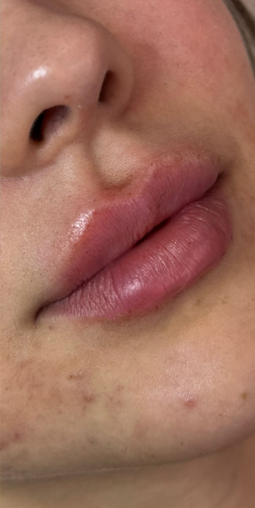 Depois da harmonização